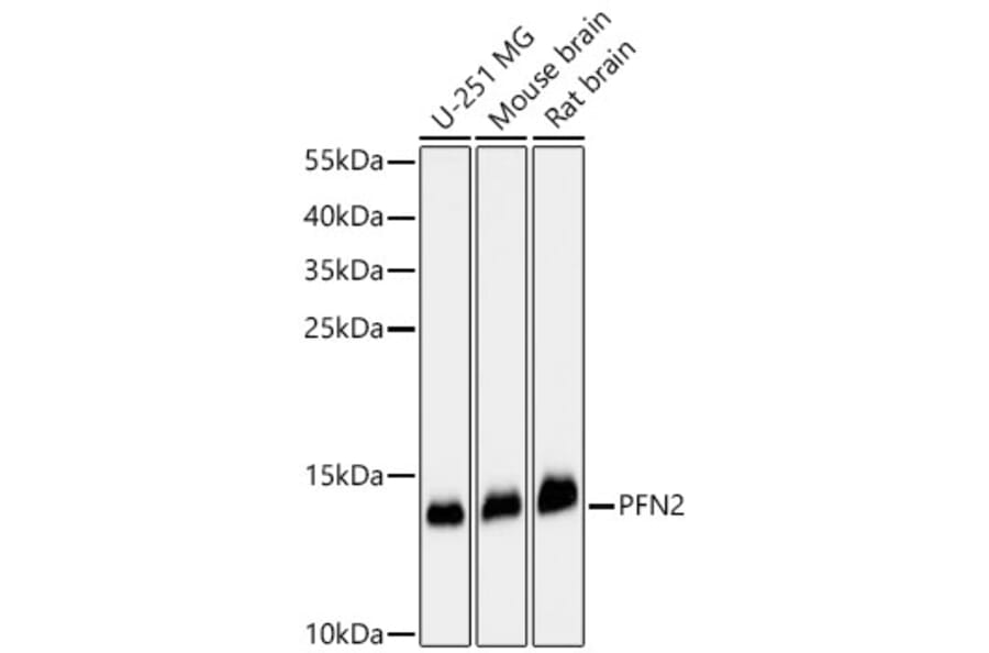 Western Blot - Anti-Profilin 2 Antibody (A329778) - Antibodies.com