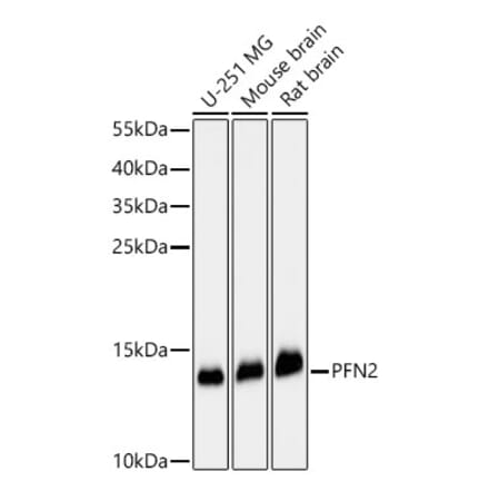 Western Blot - Anti-Profilin 2 Antibody (A329778) - Antibodies.com