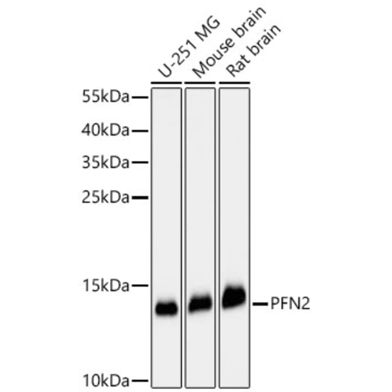 Western Blot - Anti-Profilin 2 Antibody (A329778) - Antibodies.com