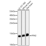 Western Blot - Anti-Profilin 2 Antibody (A329778) - Antibodies.com