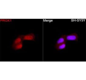 Immunofluorescence - Anti-PROX1 Antibody (A329780) - Antibodies.com