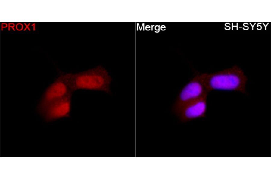 Immunofluorescence - Anti-PROX1 Antibody (A329780) - Antibodies.com