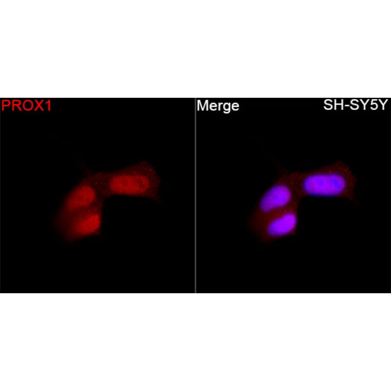 Immunofluorescence - Anti-PROX1 Antibody (A329780) - Antibodies.com