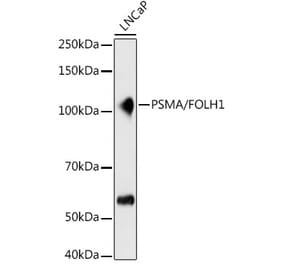 Western Blot - Anti-PSMA Antibody [ARC1628] (A329782) - Antibodies.com