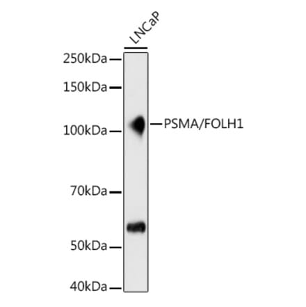 Western Blot - Anti-PSMA Antibody [ARC1628] (A329782) - Antibodies.com