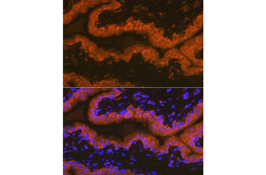 Immunofluorescence - Anti-PSMA Antibody [ARC1628] (A329782) - Antibodies.com