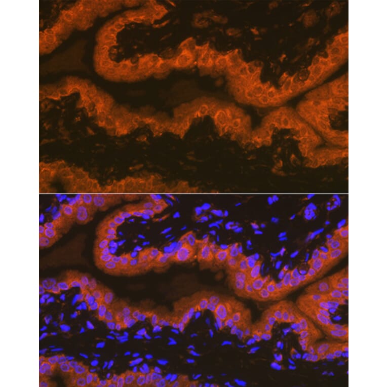 Immunofluorescence - Anti-PSMA Antibody [ARC1628] (A329782) - Antibodies.com