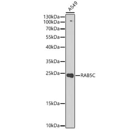 Western Blot - Anti-RAB5C Antibody (A329783) - Antibodies.com