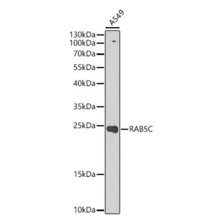 Western Blot - Anti-RAB5C Antibody (A329783) - Antibodies.com