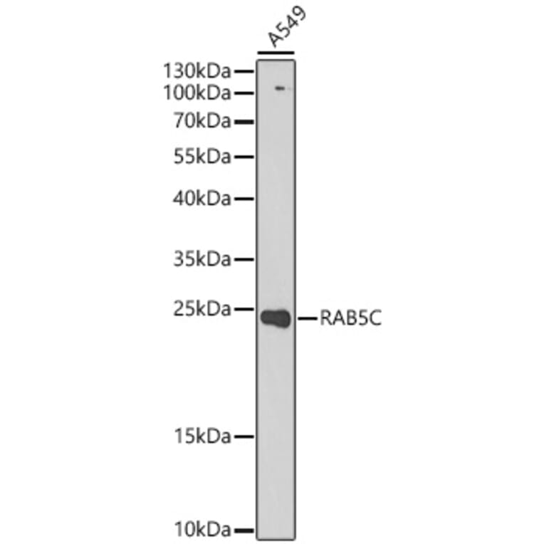 Western Blot - Anti-RAB5C Antibody (A329783) - Antibodies.com