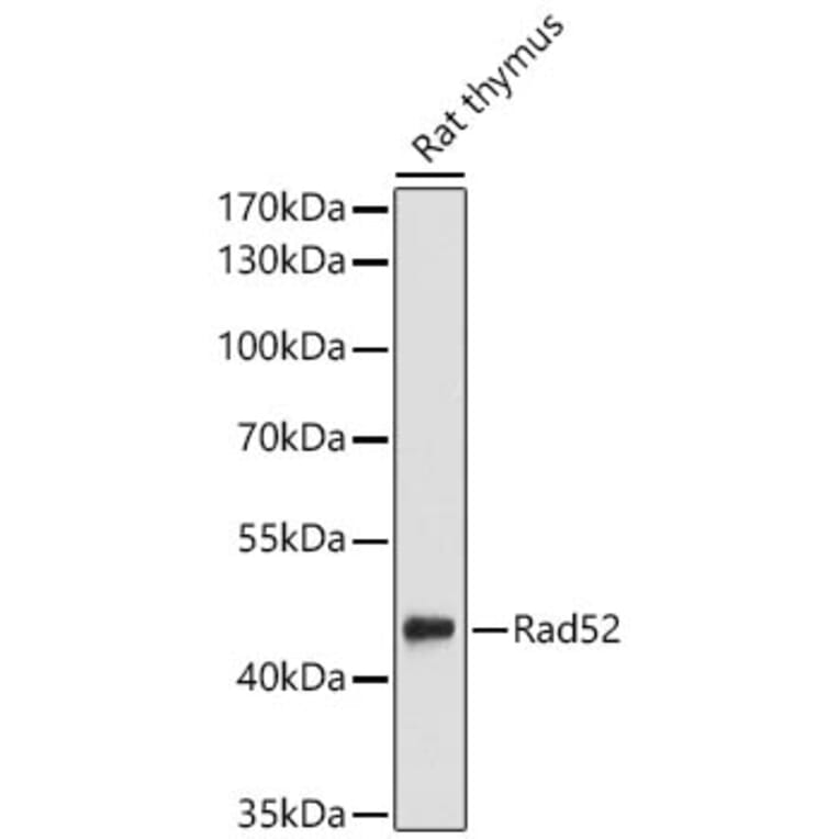 Western Blot - Anti-RAD52 Antibody (A329784) - Antibodies.com