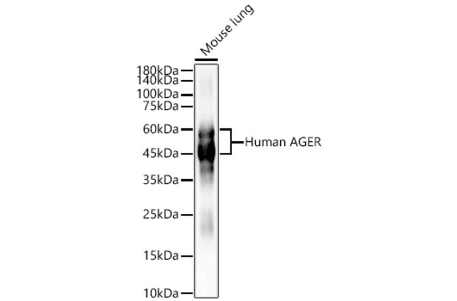 Western Blot - Anti-RAGE Antibody (A329785) - Antibodies.com