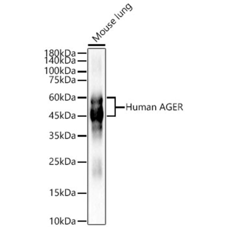 Western Blot - Anti-RAGE Antibody (A329785) - Antibodies.com