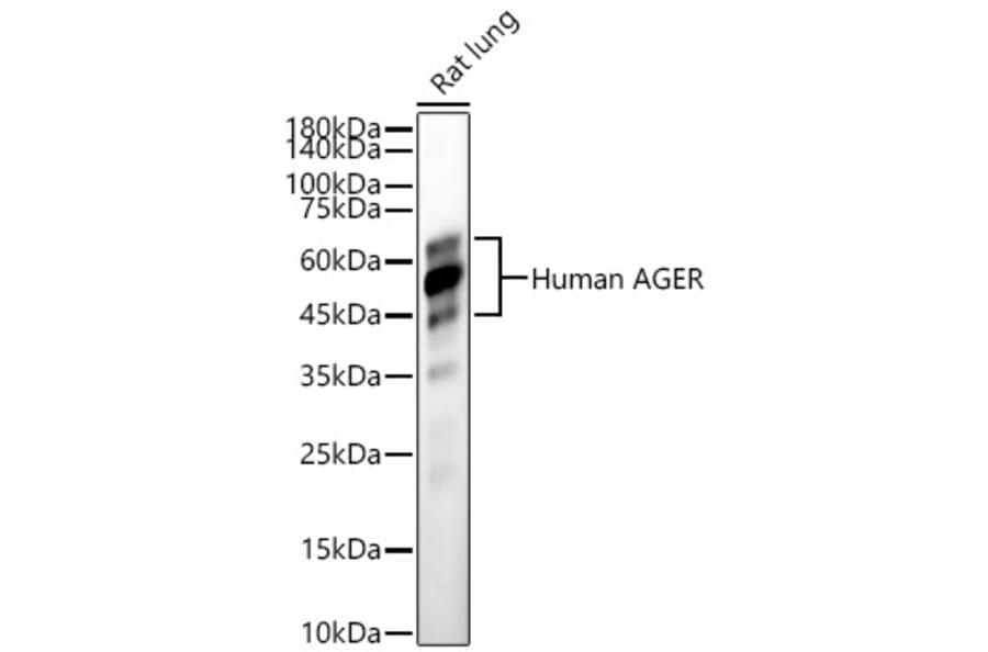 Western Blot - Anti-RAGE Antibody (A329785) - Antibodies.com