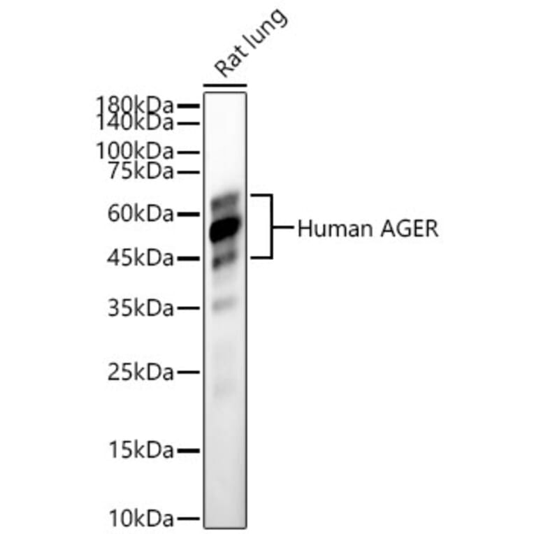 Western Blot - Anti-RAGE Antibody (A329785) - Antibodies.com
