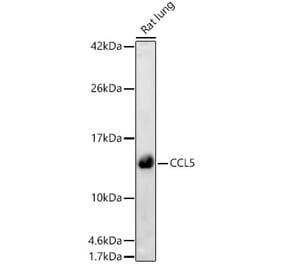 Western Blot - Anti-RANTES Antibody (A329789) - Antibodies.com