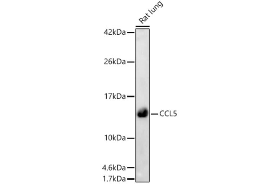 Western Blot - Anti-RANTES Antibody (A329789) - Antibodies.com