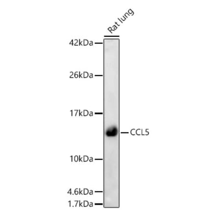 Western Blot - Anti-RANTES Antibody (A329789) - Antibodies.com