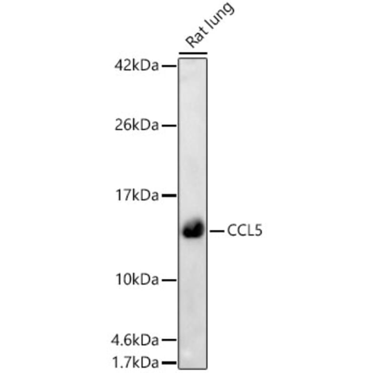Western Blot - Anti-RANTES Antibody (A329789) - Antibodies.com