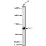 Western Blot - Anti-RANTES Antibody (A329789) - Antibodies.com