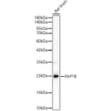 Western Blot - Anti-RAP1B Antibody (A329790) - Antibodies.com