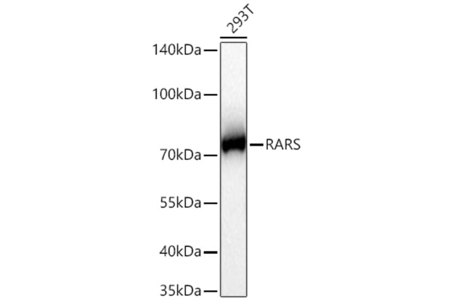 Western Blot - Anti-RARS Antibody [ARC65518] (A329792) - Antibodies.com
