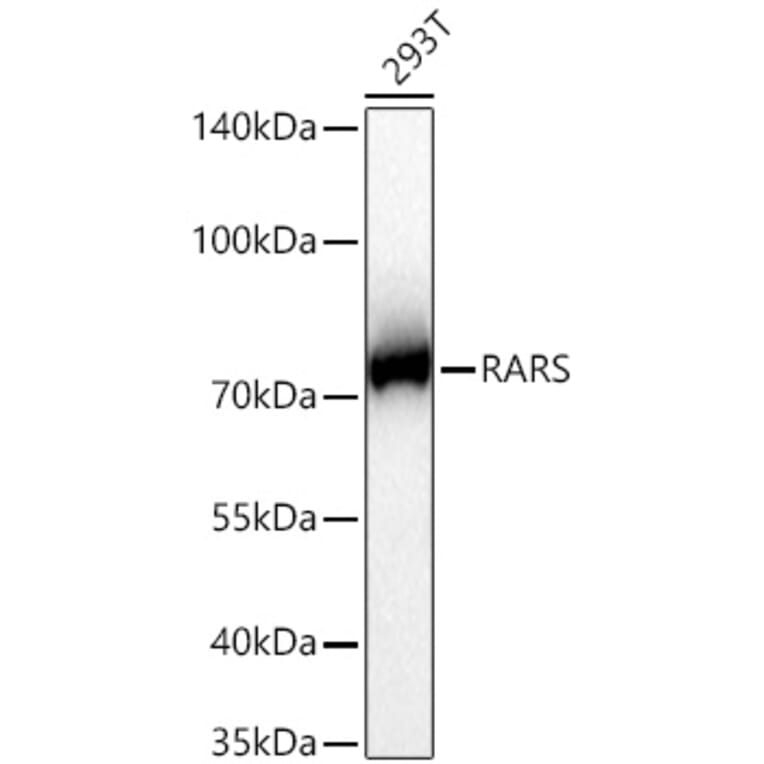 Western Blot - Anti-RARS Antibody [ARC65518] (A329792) - Antibodies.com