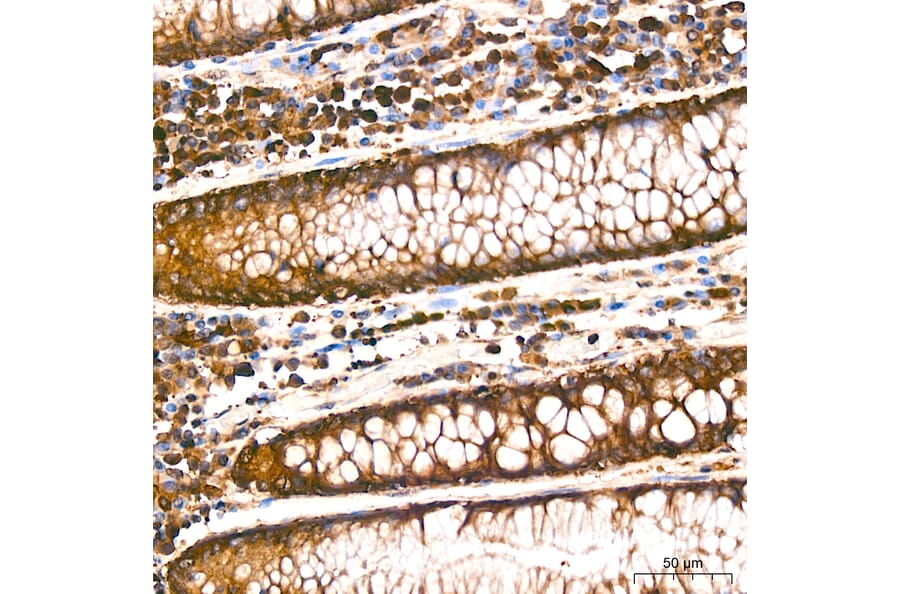 Immunohistochemistry - Anti-RARS Antibody [ARC65518] (A329792) - Antibodies.com