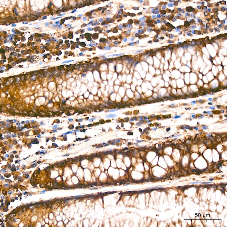 Immunohistochemistry - Anti-RARS Antibody [ARC65518] (A329792) - Antibodies.com