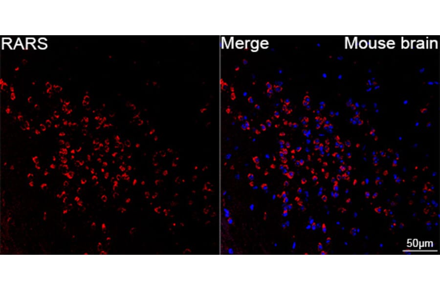 Immunofluorescence - Anti-RARS Antibody [ARC65518] (A329792) - Antibodies.com