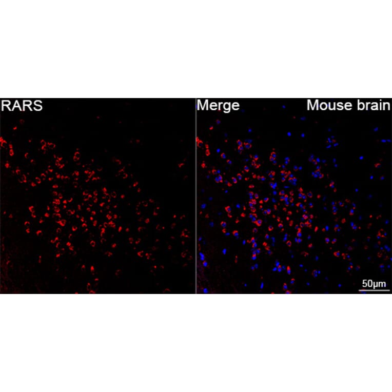 Immunofluorescence - Anti-RARS Antibody [ARC65518] (A329792) - Antibodies.com