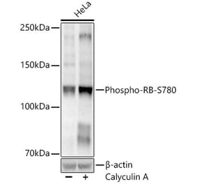 Western Blot - Anti-Rb (Phospho S780) Antibody (A329793) - Antibodies.com