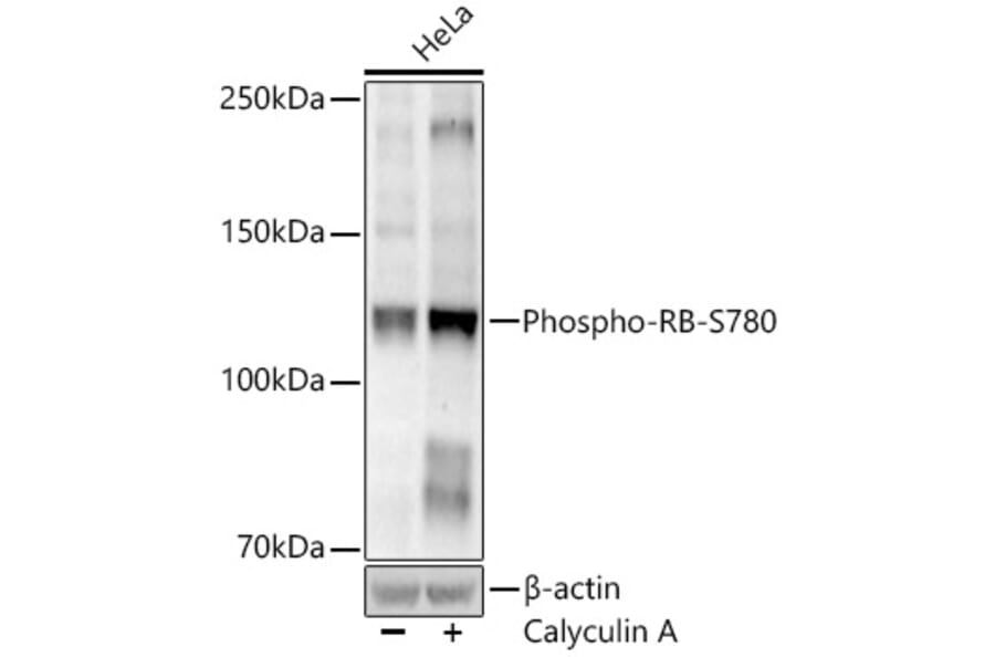Western Blot - Anti-Rb (Phospho S780) Antibody [ARC52461] (A329793) - Antibodies.com