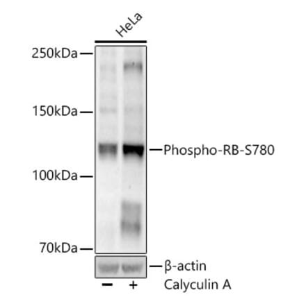 Western Blot - Anti-Rb (Phospho S780) Antibody [ARC52461] (A329793) - Antibodies.com