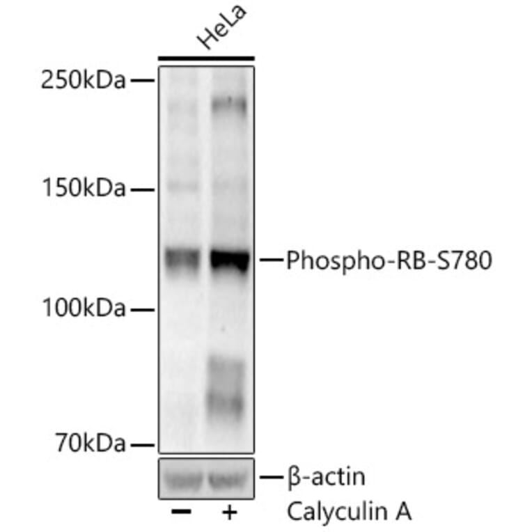 Western Blot - Anti-Rb (Phospho S780) Antibody [ARC52461] (A329793) - Antibodies.com