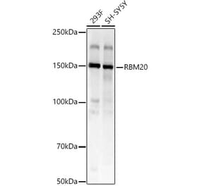 Western Blot - Anti-RBM20 Antibody (A329794) - Antibodies.com