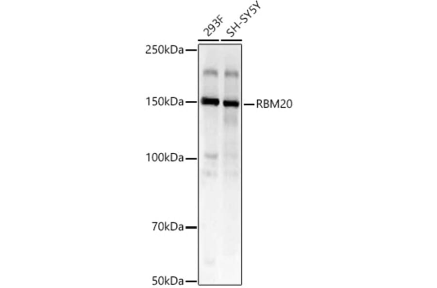 Western Blot - Anti-RBM20 Antibody (A329794) - Antibodies.com
