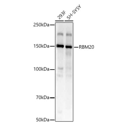 Western Blot - Anti-RBM20 Antibody (A329794) - Antibodies.com