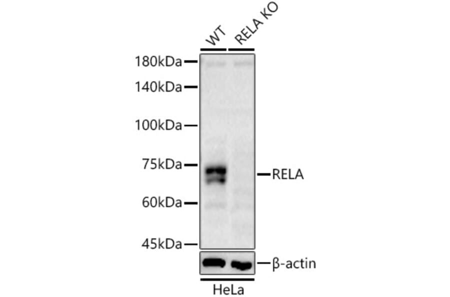 Western Blot - Anti-RELA Antibody (A329795) - Antibodies.com