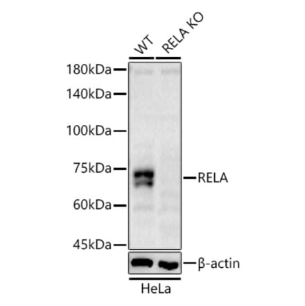 Western Blot - Anti-RELA Antibody (A329795) - Antibodies.com