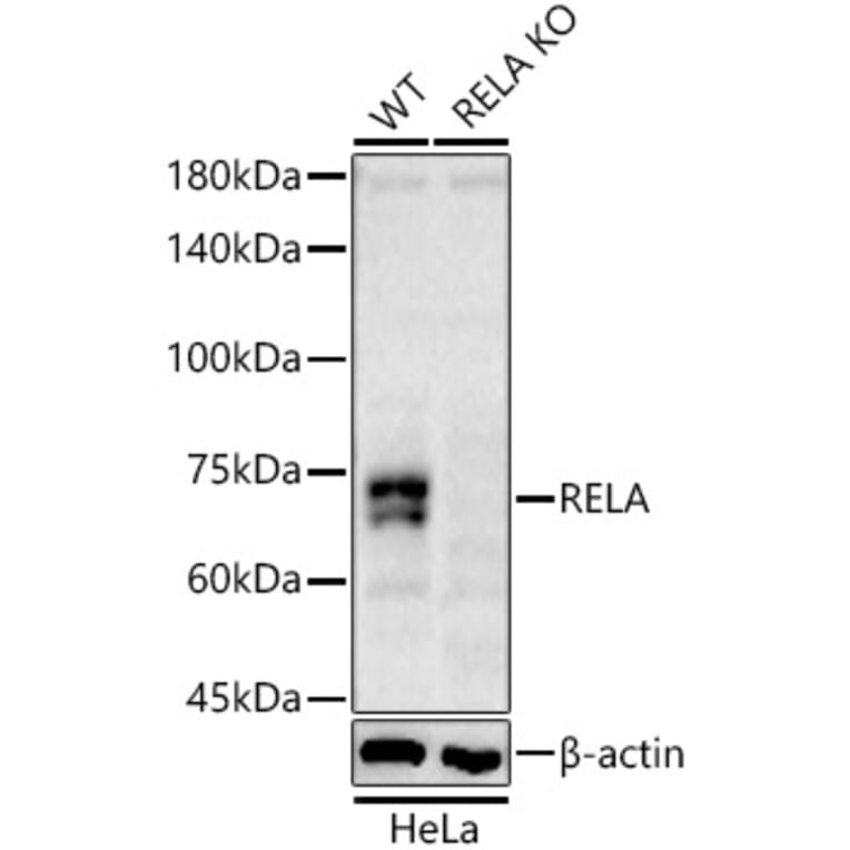Western Blot - Anti-RELA Antibody (A329795) - Antibodies.com