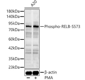 Western Blot - Anti-RelB (Phospho S573) Antibody (A329796) - Antibodies.com