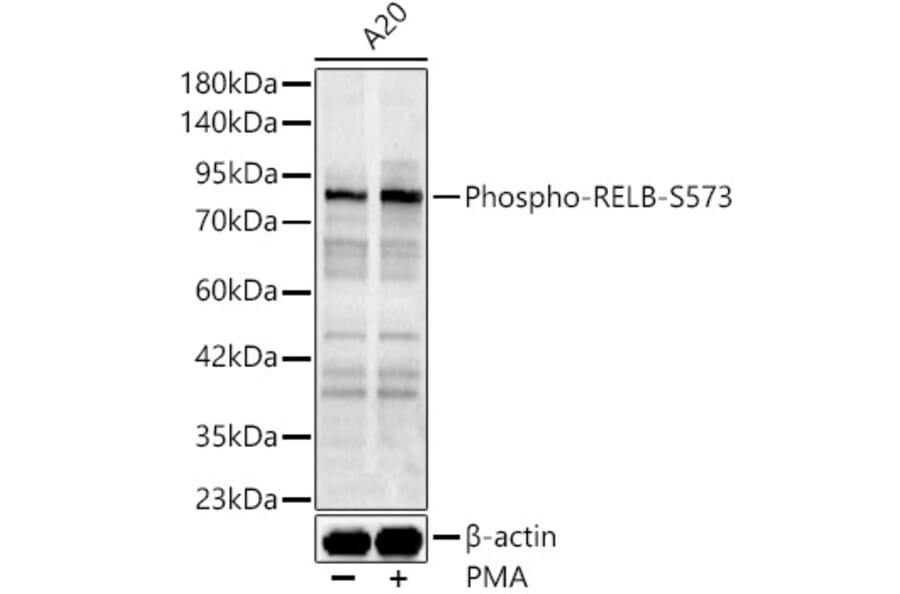 Western Blot - Anti-RelB (Phospho S573) Antibody (A329796) - Antibodies.com