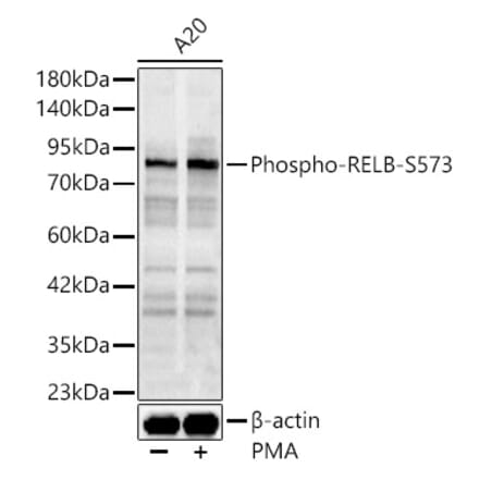 Western Blot - Anti-RelB (Phospho S573) Antibody (A329796) - Antibodies.com