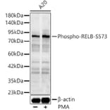 Western Blot - Anti-RelB (Phospho S573) Antibody (A329796) - Antibodies.com