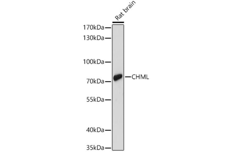 Western Blot - Anti-REP-2 Antibody (A329797) - Antibodies.com