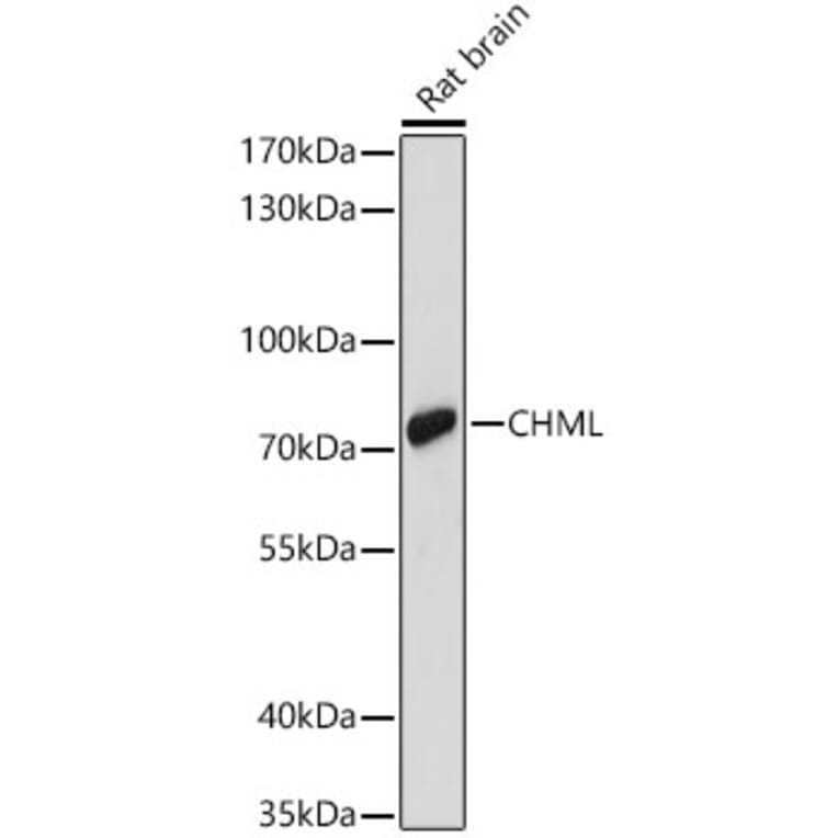 Western Blot - Anti-REP-2 Antibody (A329797) - Antibodies.com