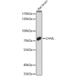 Western Blot - Anti-REP-2 Antibody (A329797) - Antibodies.com