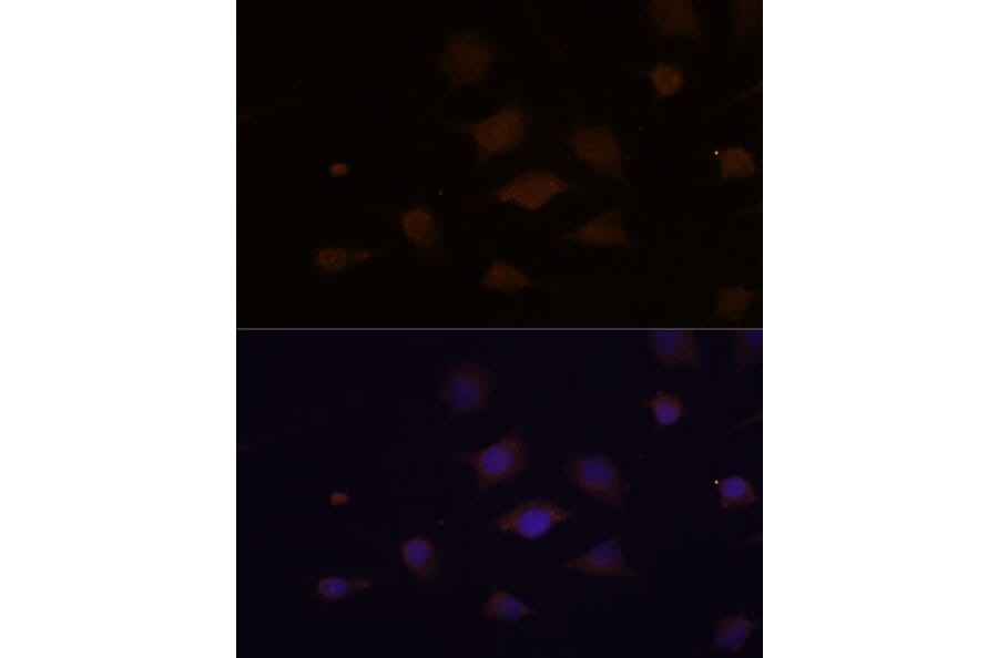 Immunofluorescence - Anti-REP-2 Antibody (A329797) - Antibodies.com