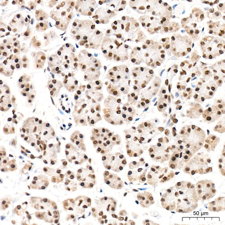 Immunohistochemistry - Anti-REPIN1 Antibody (A329798) - Antibodies.com